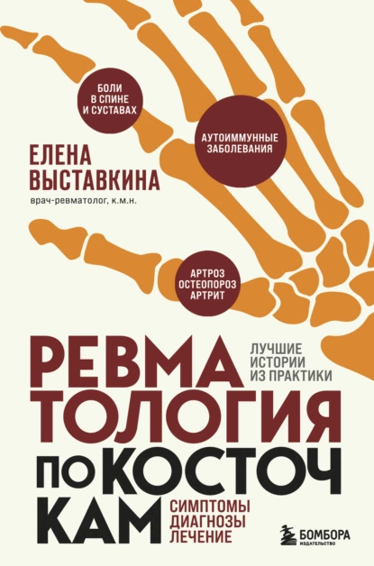 Ревматология по косточкам
