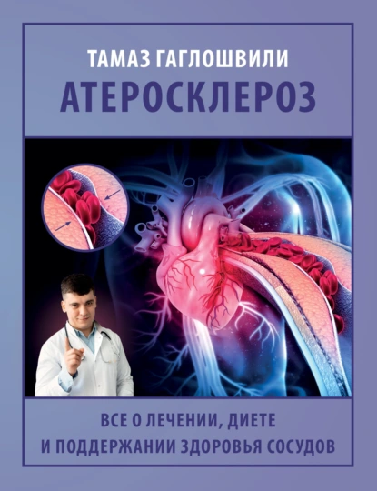 Тамаз Гаглошвили «Атеросклероз. Все о лечении, диете и поддержании здоровья сосудов» скачать бесплатно